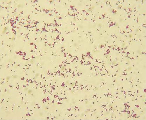 Окрашенные по Грамму бактерии Streptococcus iniae оскара