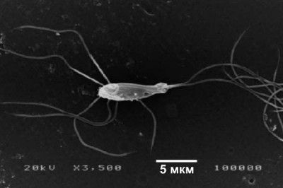 Растровая электронная микроскопия жгутиконосца Spironucleus vortens, взятого с головы дискуса. Это главный, подтвержденный возбудитель гексамитоза у тропических аквариумных рыб. Увеличение в 3500 раз. Масштаб 5 мкм (фото - www.int-res.com/articles/dao/45/d045p197.pdf) По ссылке имеются другие фотографии с обозначением отдельных органелл