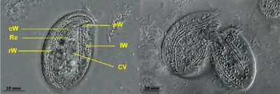 Chilodonella uncinata; брюшная сторона: Циркулярный ряд ротовых ресничек (cW), пищеварительная вакуоль (Re), поле ресничек справа (rW), предротовые реснички (pW), поле ресничек слева (lW) и сократительная вакуоль (KV) (илл. www.plingfactory.de/Science/Atlas/KennkartenProtista/source/Chilodonella_uncinata.html)