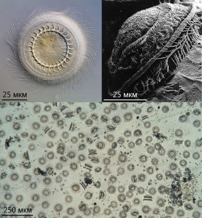 Триходины (Trichodina-sp)