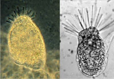Сидячие инфузории (Trichophyra spp.)
